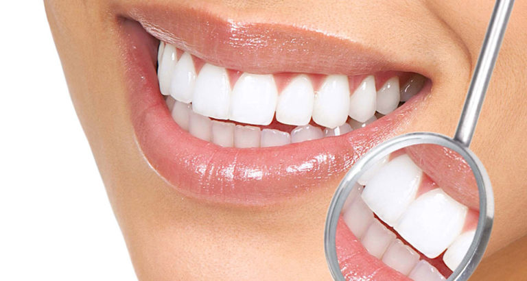 ‘Lente de contato’ para dente garante sorriso sem imperfeições