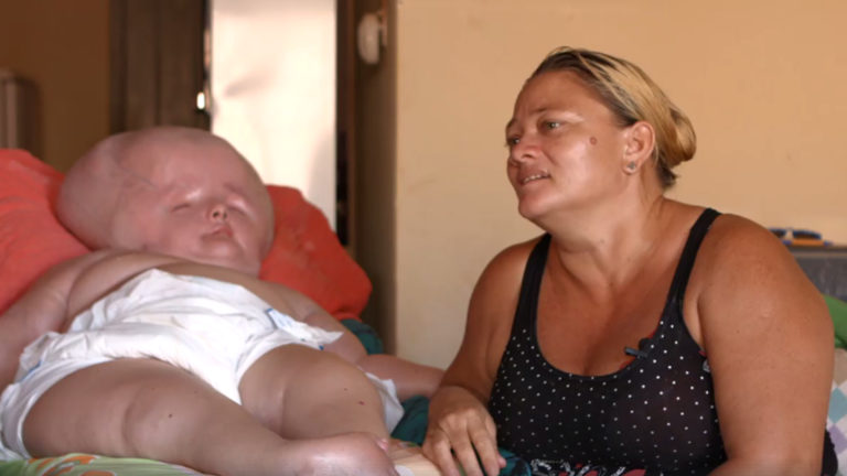 A história de vida de Graziely, que sofre de hidrocefalia
