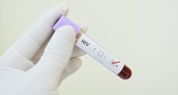 São Luís é a 3ª capital com mais registros de HIV e Aids, mas diagnóstico não é sentença de morte