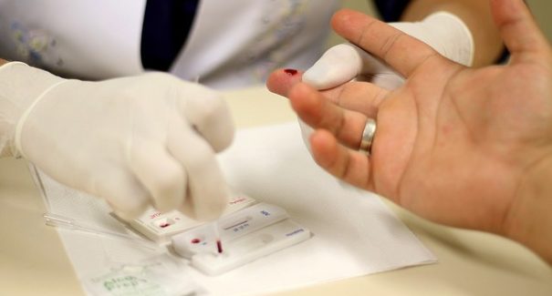 No Maranhão só 45,3% dos casos de HIV são registrados e notificados 