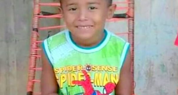 João Miguel que teve 60% do corpo queimado morre em Goiânia