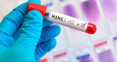 Maranhão tem 15 casos confirmados de H1N1