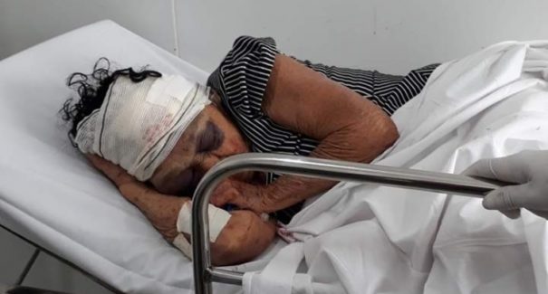 Idosa de 81 anos morre após  ser espancada em assalto no Maranhão