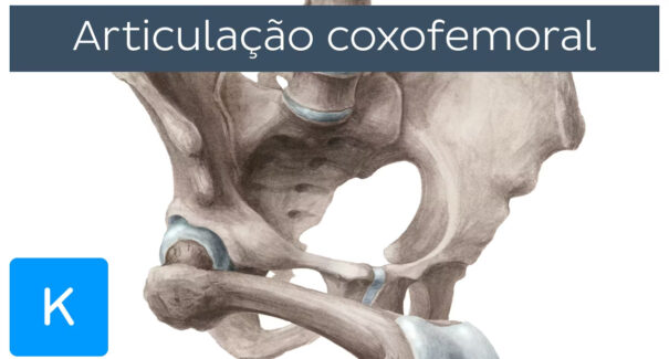 Entenda como é a cirurgia no quadril que o presidente Lula fará em breve