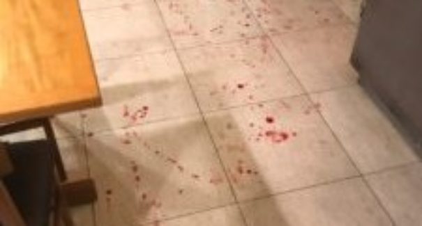 Mulher é agredida em pizzaria de São Luís