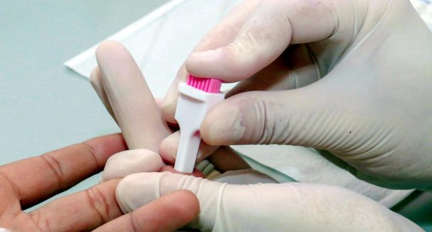 Ações de apoio e assistência às pessoas com HIV são intensificadas em São Luís