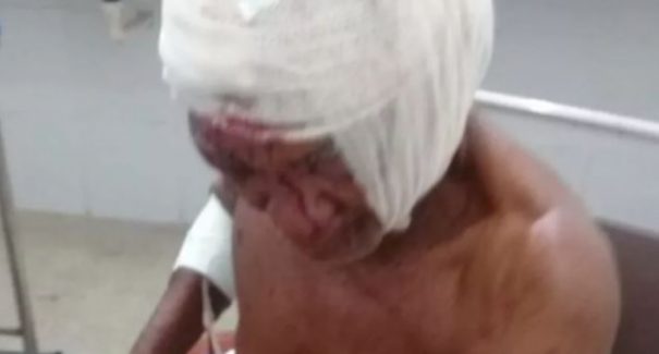 Idoso é atacado e esfaqueado  por adolescente no interior do Maranhão