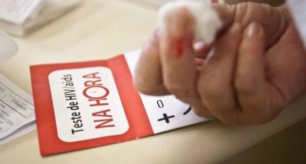 135 mil brasileiros não sabem que têm HIV, estima Ministério da Saúde