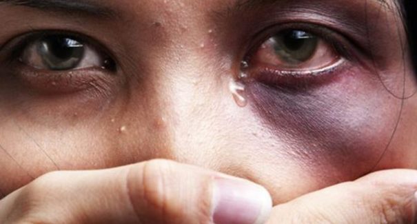 Jovem é espancada após mexer no celular do namorado