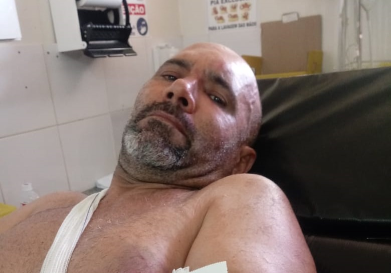 Motorista é baleado e tem caçamba roubada durante assalto
