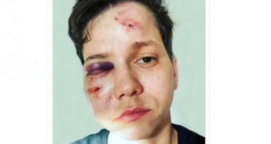 Apoiadora de Bolsonaro é agredida em ataque homofóbico