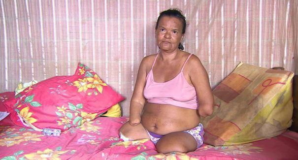 Mulher sem mãos tem INSS negado por não poder assinar papéis