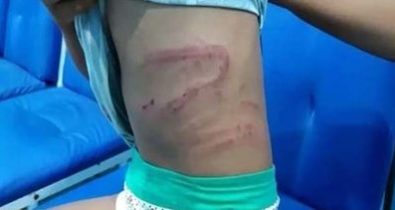 Polícia investiga caso de agressão à criança no Maranhão