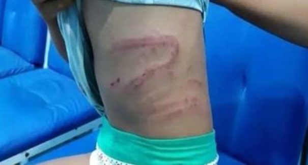 Polícia investiga caso de agressão à criança no Maranhão