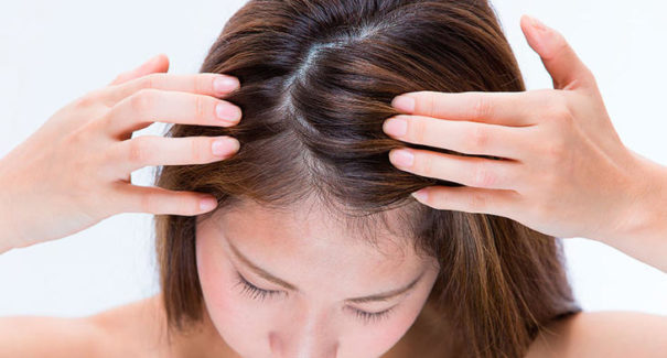 5 receitas caseiras para acabar com a caspa