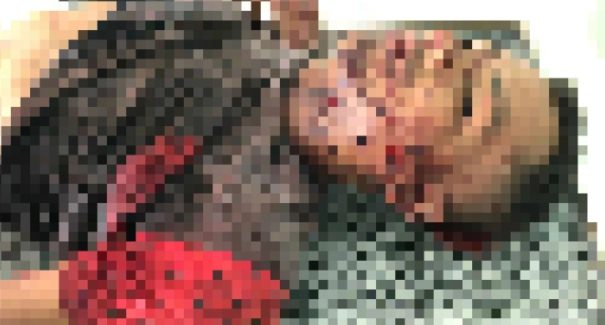 Homem é assassinado com 12 tiros na cabeça em Codó