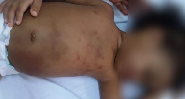 Criança de dois anos é agredida pela mãe e passa por cirurgia