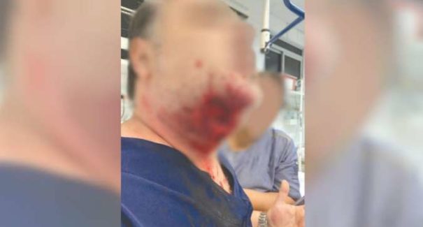 Paciente se irrita e morde pescoço de médico