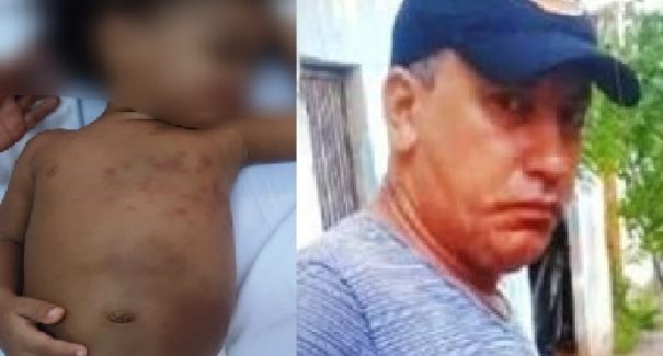 Padrasto é suspeito de participar de agressões contra criança de dois anos