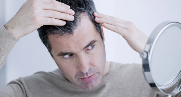 Quais são os primeiros sinais da calvície em homens?