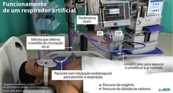 Coronavírus provoca guerra por respiradores artificiais no Brasil