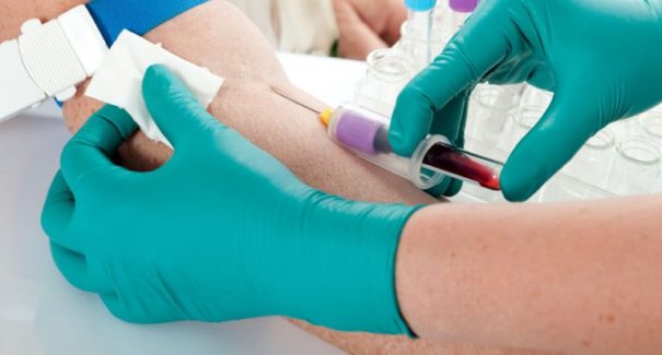 Laboratório móvel de análises clínicas é inaugurado em Itapecuru-Mirim