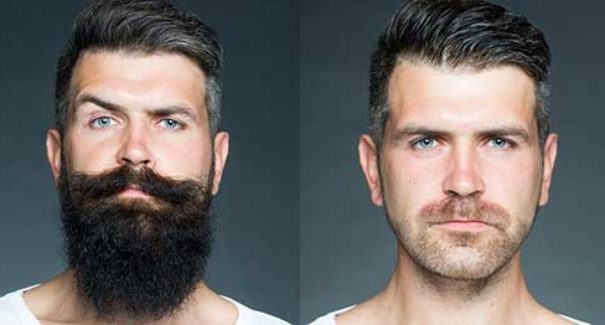 Como usar e para que serve? Veja realmente se o Minoxidil funciona