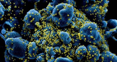 Veja imagens das células humanas sob ataque do coronavírus
