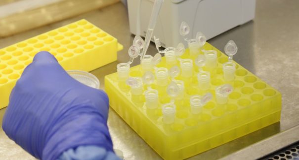 Número de casos de covid-19 confirmados no Brasil sobe para 1.128