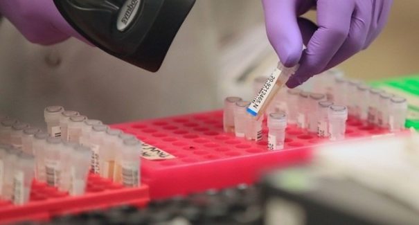 SES esclarece caso suspeito de coronavírus em condomínio de São Luís