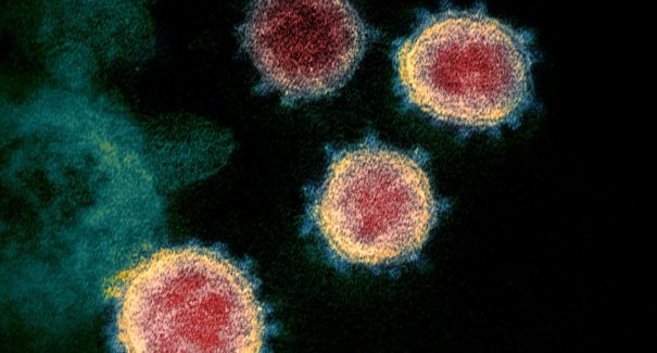 Brasil passa de 20 mil casos confirmados e 1.124 mortos por Covid-19