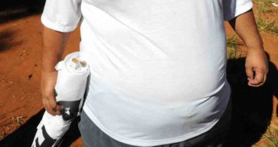 Obesidade é o principal fator de risco para pacientes com menos de 60 anos