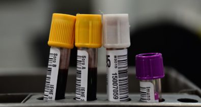 Hemorio inicia testes com plasma sanguíneo no tratamento de covid-19