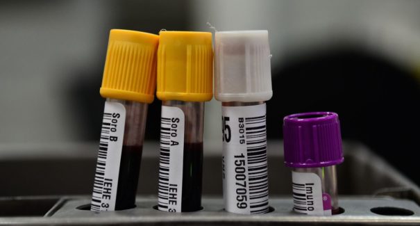 Hemorio inicia testes com plasma sanguíneo no tratamento de covid-19