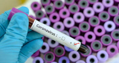 Maranhão tem 293 casos confirmados de coronavírus
