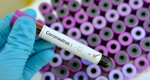 Paço do Lumiar registra primeiro caso do novo coronavírus