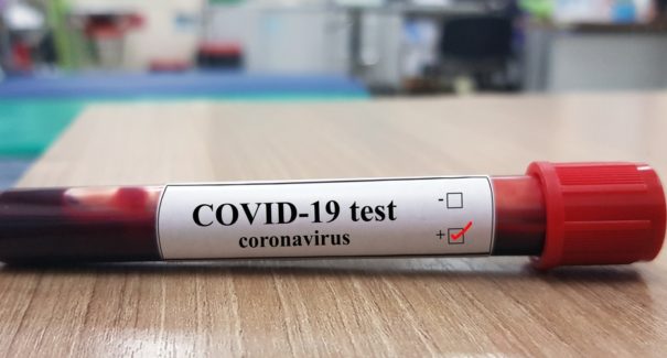 Maranhão chega a 81 casos confirmados do novo coronavírus