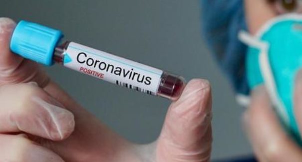 Vacina de Oxford contra Coronavírus começa a ser testada no Brasil