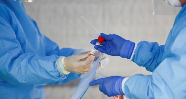 Instituto desenvolve teste rápido para detectar covid-19