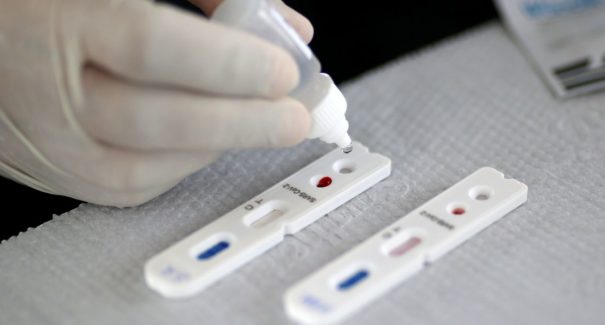 Saiba como fazer o teste diagnóstico de covid-19 pelo plano de saúde