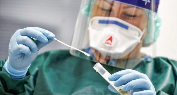Terapia com anticorpos pode iniciar testes até setembro