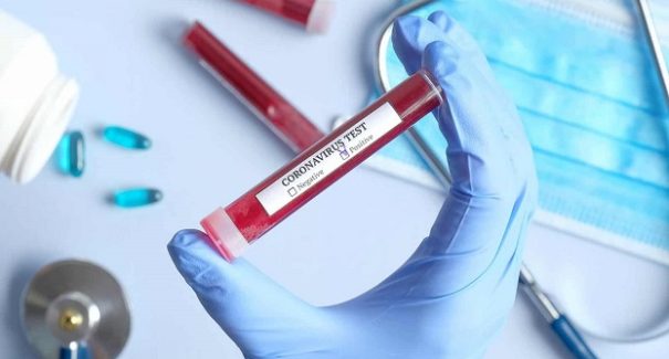 Maranhão registra 3.035 pacientes curados do novo coronavírus