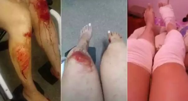 Mulher se joga de carro em movimento para evitar estupro
