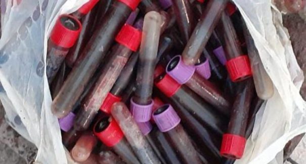 Polícia investiga o que está por trás das ampolas com sangue encontradas na Praia do Araçagi