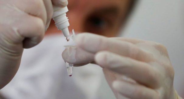 OMS: números de casos e mortes no Brasil ainda são altos e quadro preocupa