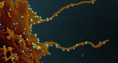 Coronavírus: imagens microscópicas revelam tentáculos nas células infectadas