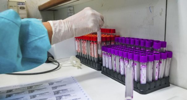 Brasil tem 2,7 milhões de casos e 93,6 mil mortes por covid-19