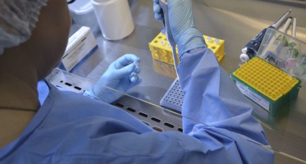 Pesquisadores desenvolvem testes rápidos para diagnóstico de covid-19
