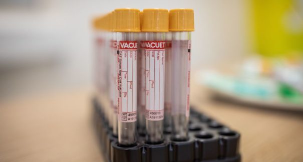 Plataforma faz monitoramento remoto de pacientes com covid-19