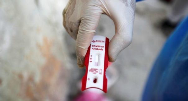 Família de profissionais de saúde mortos por covid-19 tem direito a R$ 50 mil